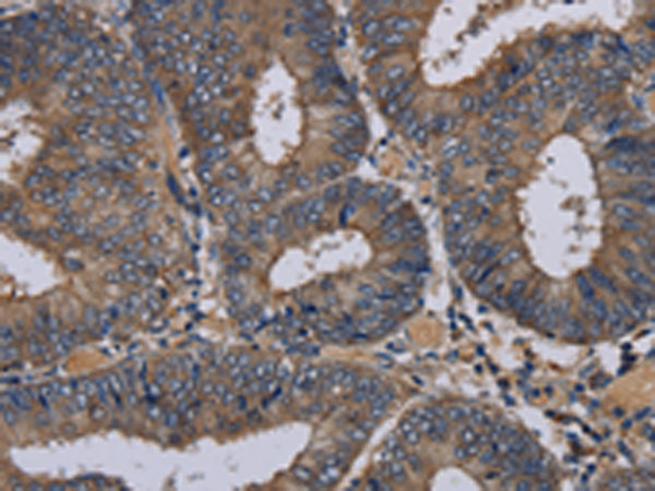 Rabbit Polyclonal Antibody to NECTIN3