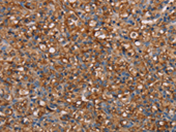 Rabbit Polyclonal Antibody to NEDD4L