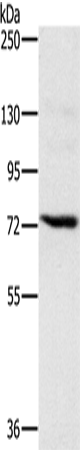 Rabbit Polyclonal Antibody to NCSTN