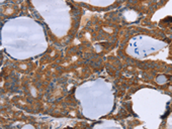 Rabbit Polyclonal Antibody to PITPNM1