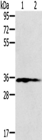 Rabbit Polyclonal Antibody to NIT1