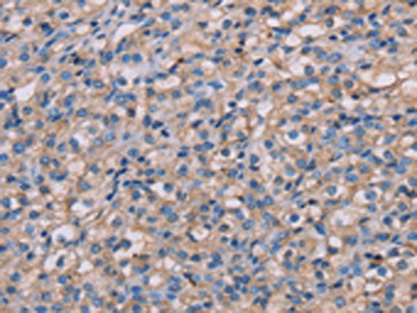 Rabbit Polyclonal Antibody to NMT2