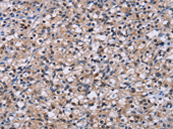 Rabbit Polyclonal Antibody to NR1D1