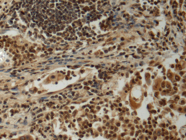 Rabbit Polyclonal Antibody to NRIP1