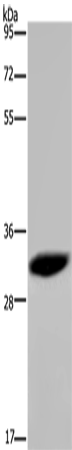 Rabbit Polyclonal Antibody to HMGN5