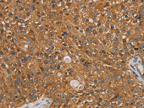 Rabbit Polyclonal Antibody to NT5C1A