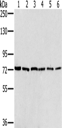 Rabbit Polyclonal Antibody to NUMB