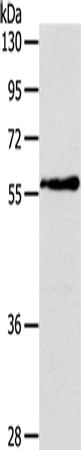 Rabbit Polyclonal Antibody to OLFM4