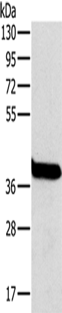 Rabbit Polyclonal Antibody to OTC