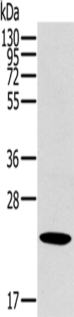 Rabbit Polyclonal Antibody to OTUB2