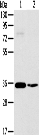 Rabbit Polyclonal Antibody to OTUB1