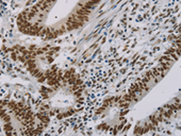 Rabbit Polyclonal Antibody to ZMAT3
