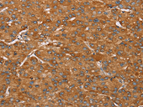 Rabbit Polyclonal Antibody to PAGE5