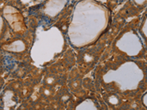 Rabbit Polyclonal Antibody to PAGE2