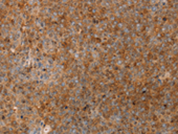 Rabbit Polyclonal Antibody to SERPINB2