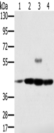 Rabbit Polyclonal Antibody to PAICS