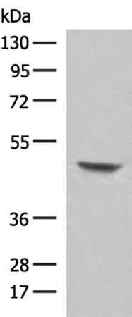 Rabbit Polyclonal Antibody to PNLIP