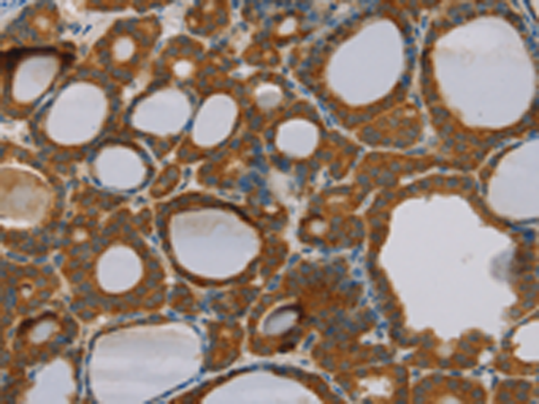 Rabbit Polyclonal Antibody to PARL