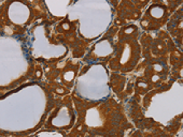 Rabbit Polyclonal Antibody to PARP3