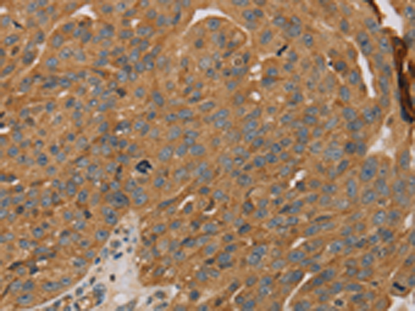 Rabbit Polyclonal Antibody to PARP11