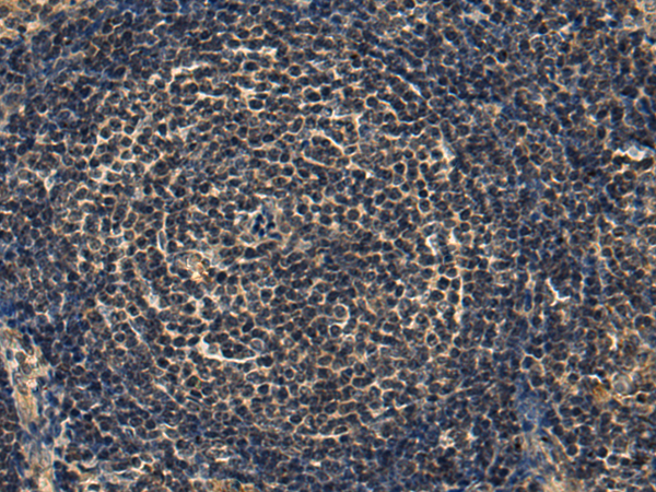Rabbit Polyclonal Antibody to PDGFD