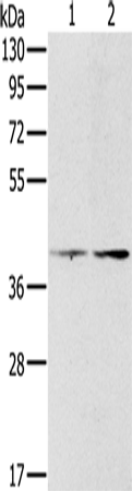 Rabbit Polyclonal Antibody to PDGFRL