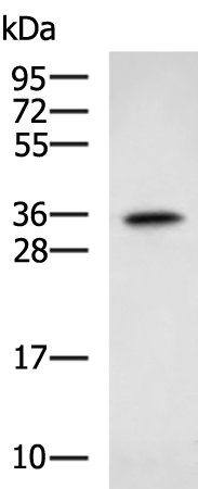 Rabbit Polyclonal Antibody to PDHB