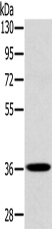 Rabbit Polyclonal Antibody to PDLIM1