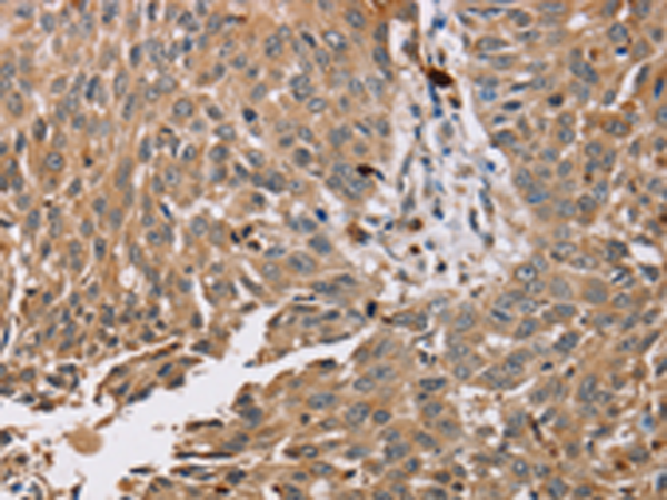 Rabbit Polyclonal Antibody to PDLIM7