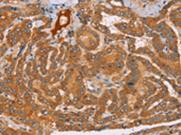 Rabbit Polyclonal Antibody to PEA15