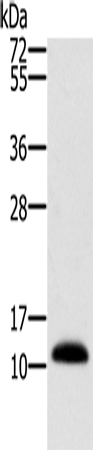 Rabbit Polyclonal Antibody to MSMB