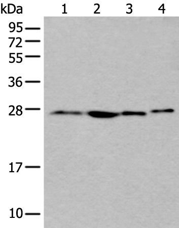 Rabbit Polyclonal Antibody to ANP32A