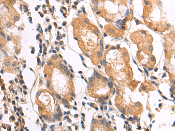 Rabbit Polyclonal Antibody to EGLN1