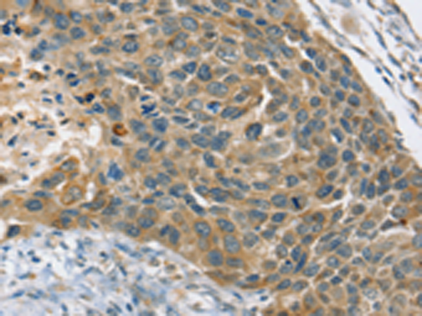 Rabbit Polyclonal Antibody to PHKB