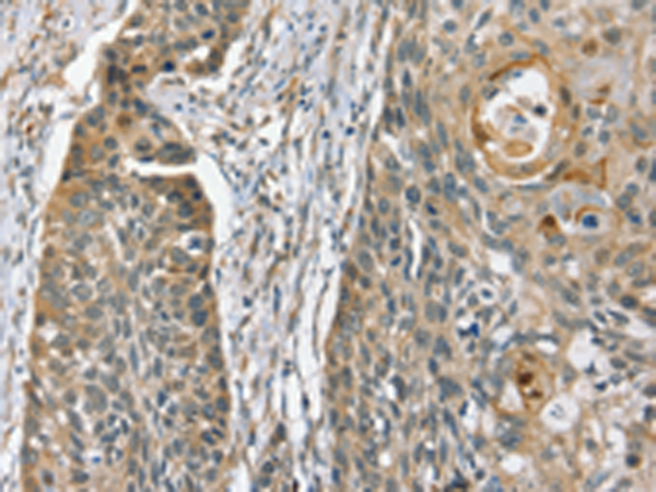 Rabbit Polyclonal Antibody to PHLPP1