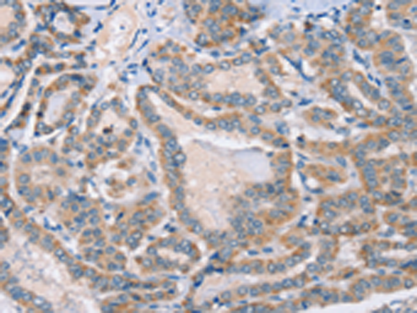 Rabbit Polyclonal Antibody to PHYH