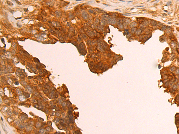 Rabbit Polyclonal Antibody to PRKACB