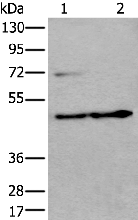 Rabbit Polyclonal Antibody to PRKAR2A