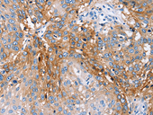 Rabbit Polyclonal Antibody to PLCZ1