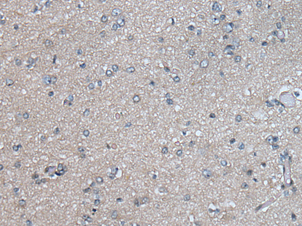 Rabbit Polyclonal Antibody to PLK4