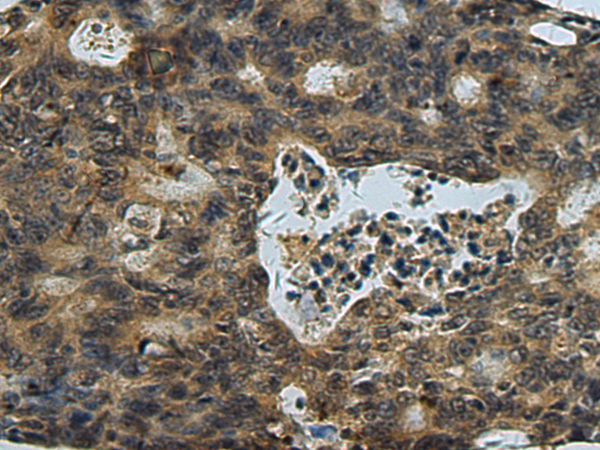 Rabbit Polyclonal Antibody to PLTP