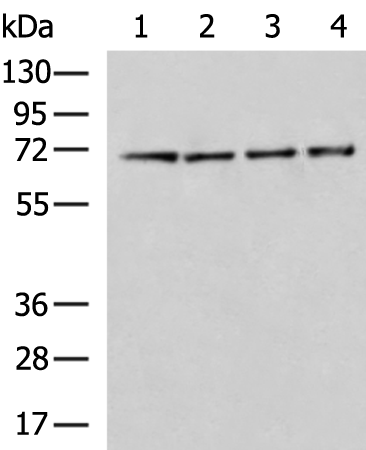 Rabbit Polyclonal Antibody to ZBTB16