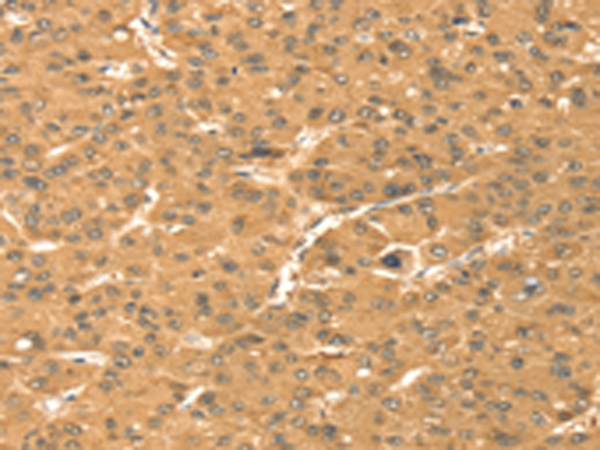 Rabbit Polyclonal Antibody to TMEM123