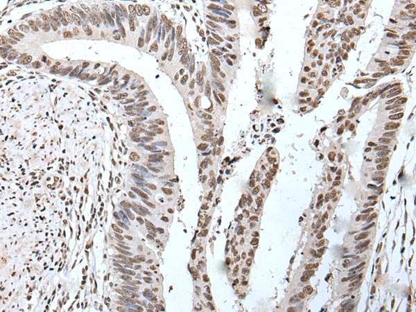Rabbit Polyclonal Antibody to POT1