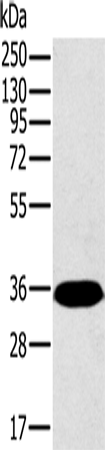 Rabbit Polyclonal Antibody to PPP2CA