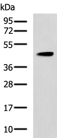 Rabbit Polyclonal Antibody to PPM1A