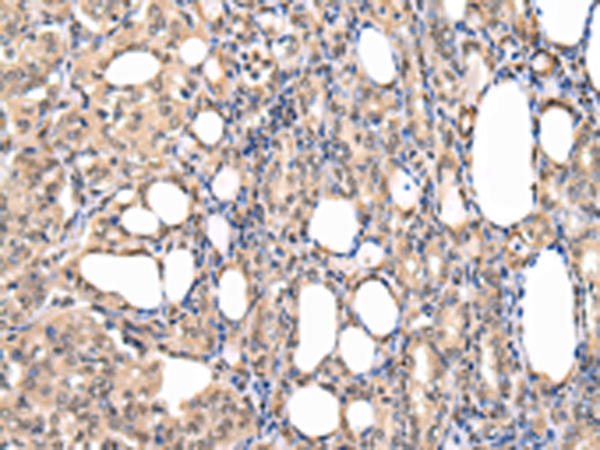 Rabbit Polyclonal Antibody to PPIL1