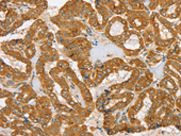Rabbit Polyclonal Antibody to PDP1