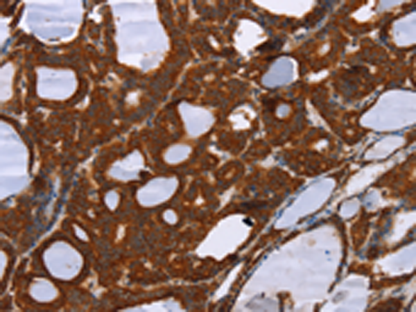 Rabbit Polyclonal Antibody to PPP2R3C