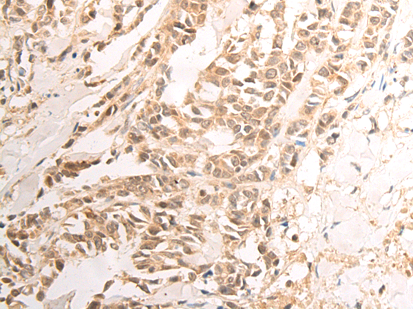 Rabbit Polyclonal Antibody to PRAME